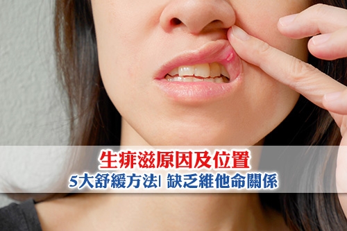 生痱滋原因及位置-5大舒緩方法-缺乏維他命關係